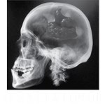 It's Not A Tumor (Shithead) It's Not A Tumor (Shithead)